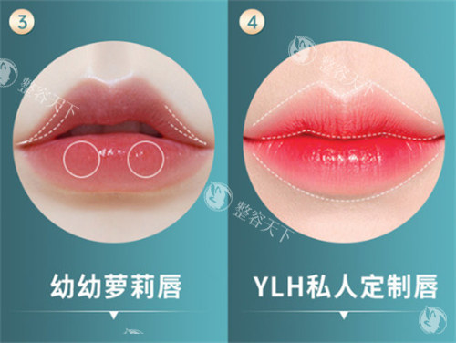 宜春韩美整形医院究竟咋样？那些去做过整形的人有话说，速来围观