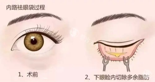 开封亿尚医疗美容怎么样?地址在哪里?特色是眼睛整形/鼻子正/幼态脸,附简介地址!
