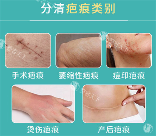 深圳安美聚光整形怎么样?地址在哪里?针剂注射/轮廓固定/吸脂塑形/疤痕修复做得好且有名!