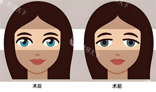 开封亿尚医疗美容怎么样?地址在哪里?特色是眼睛整形/鼻子正/幼态脸,附简介地址!