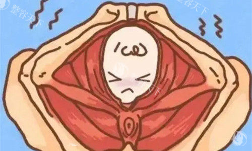 缩阴手术卡通图 缩阴手术卡通图