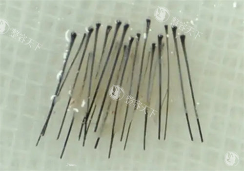 毛囊处理照片 毛囊处理照片