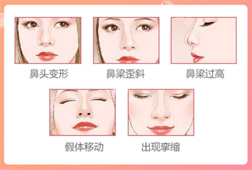 李鸿君个人资料简介全曝光!上海隆鼻医生20年经验揭秘,技术口碑如何双双封神?