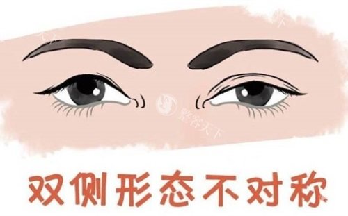 青海千慈医疗美容是正规的吗?口碑怎么样?做眼部整形/鼻部整形/微拉美提升手术出名,附简介地址!