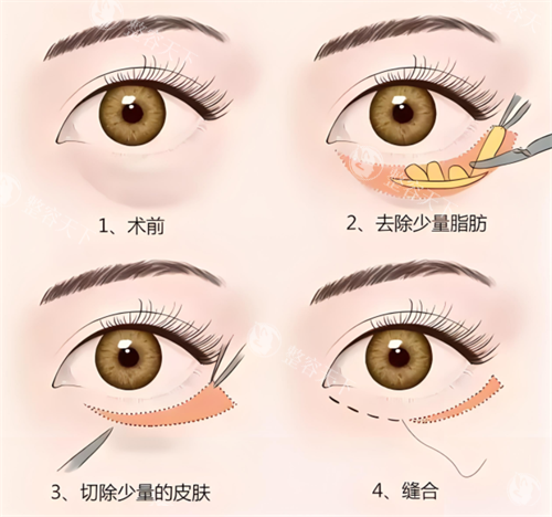 青海千慈医疗美容是正规的吗?口碑怎么样?做眼部整形/鼻部整形/微拉美提升手术出名,附简介地址!