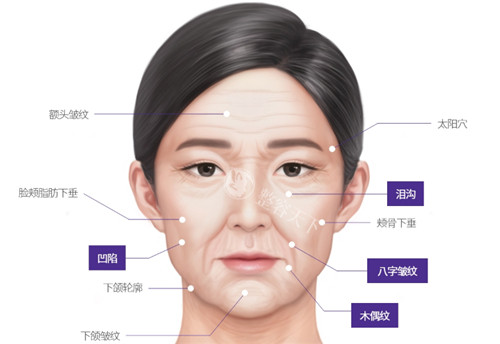 北京首玺丽格医疗美容怎么样?做埋线提升手术口碑好很出名,附简介地址及口碑评价!