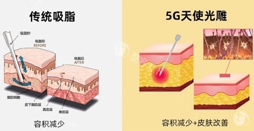 哈尔滨赫拉医疗美容医院价格表整理，一文全含各医美项目收费价格！
