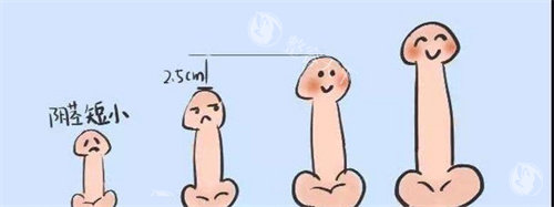 阴茎长度对比动画图 阴茎长度对比动画图