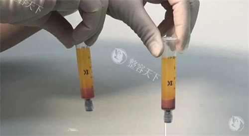 北京脂肪丰胸医生刘成胜的口碑着实不错！整友好评满满，夸技术/审美/服务的比比皆是