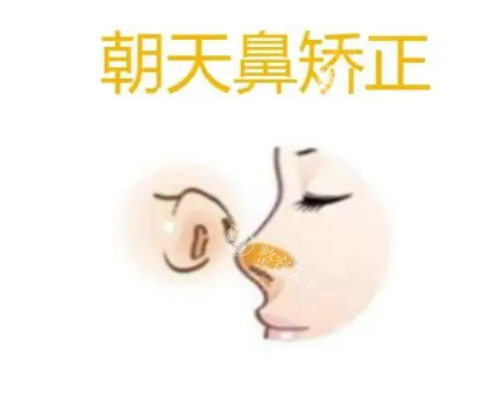 武汉同济医学院医院吴辉做鼻子怎么样，在鼻整形及修复领域技术十分成熟有多年的经验！