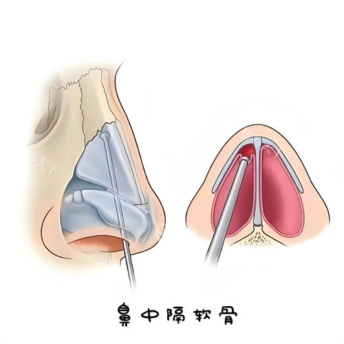 彭远清眼鼻定制比别家贵几千值吗?三段式美鼻术实录+医生简介告诉你技术不看价格!
