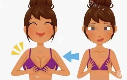 武汉同济医学院医院隆胸靠谱吗？叶子荣医生经验足、技术稳结果自然