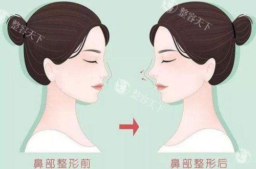 郑州悦容整形医院怎么样?郑州悦容整形是正规医院吗?分享简介|地址|口碑|预约方式!