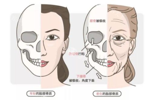 超声提拉和热玛吉哪个更好？文内从多个维度为您介绍下两方优势