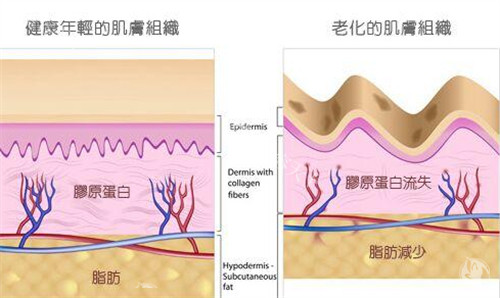2025热望童颜针VS艾维岚区别解析：价格/维持时间/认证哪家强？