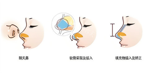 绵阳臻艺医疗美容怎么样？是一家比较正规也比较靠谱的医美整形医院！