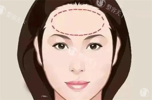 北京嘉禾整形的蔡圣民的手术水平实测:擅长各类型仪器抗衰提升,术后满意度如何