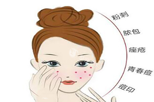 眼部汗管瘤咋消除？实用方法大揭秘，赶紧来瞧瞧！