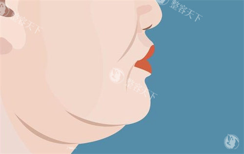 双下巴的样子卡通图 双下巴的样子卡通图