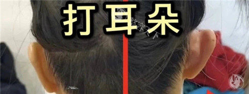 精灵耳注射图 精灵耳注射图