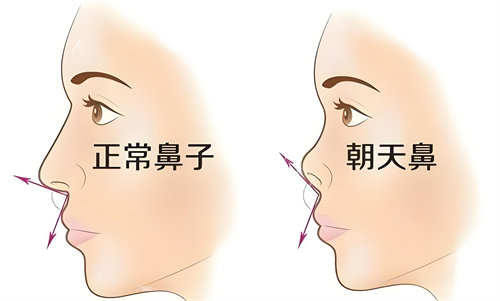 大庆艾尚美颜医疗美容技术好不好?隆鼻与做胸项目给出有力答案