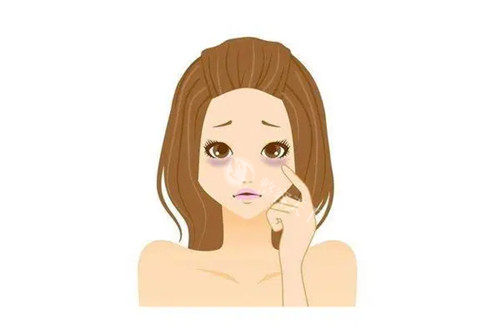 黑眼圈卡通示意图 黑眼圈卡通示意图
