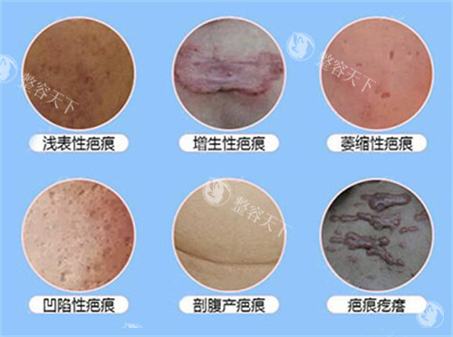 昆明皮肤病专科医院正规吗?怎么样?是私立医院但皮肤科项目技术好,附简介地址!