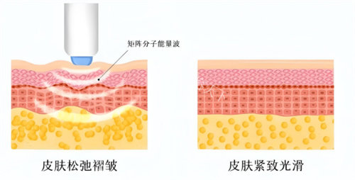 秦皇岛如壹医疗美容怎么样?地址在哪里?做眼鼻整形/热玛吉/超声炮技术好,附简介地址!