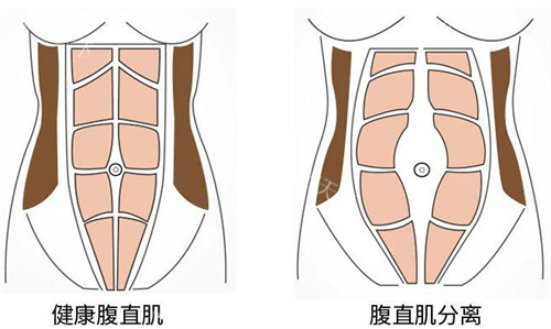 李献和医生的擅长领域：双C腰成型 /腹壁整形技术正规，还可以一台手术做2个项目!
