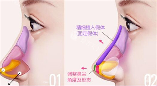 北京蓝奥医疗美容怎么样?擅长做眼鼻整形/幼态脸/吸脂手术,附简介介绍和地址位置!
