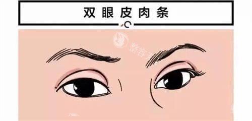 北京蓝奥医疗美容怎么样?擅长做眼鼻整形/幼态脸/吸脂手术,附简介介绍和地址位置!