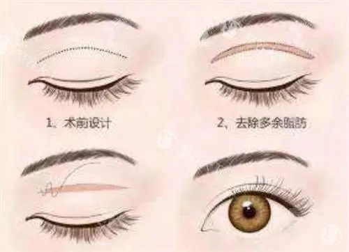 北京蓝奥医疗美容怎么样?擅长做眼鼻整形/幼态脸/吸脂手术,附简介介绍和地址位置!
