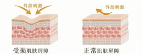皮肤屏障受损 皮肤屏障受损