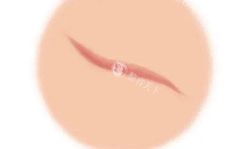 沈阳华美疤痕医院是正规医院吗？扒执照/查医生团队/收费标准，这份避雷攻略患者必看