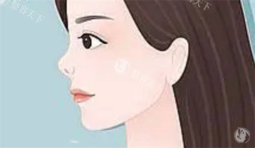 上海高毅明医生隆鼻怎么样?隆鼻技术牛,是鼻功能美学奠基人
