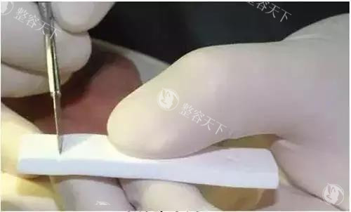 深圳西晶隆鼻价格曝光！张辉=鼻修复6万起vs初鼻价差，如何选到高性价比方案？