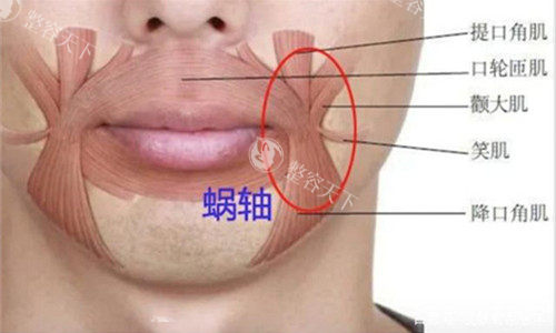 舒媞雅骨胶原可以打口周吗?能打口周,口角囊袋|木偶纹|法令纹都OK