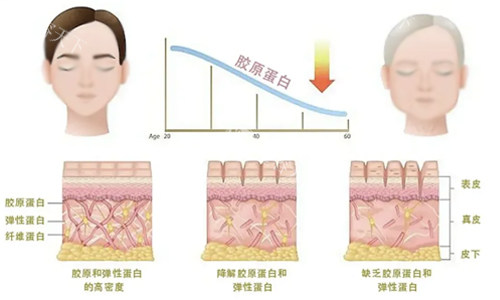 舒媞雅骨胶原多长时间打一次?因人而异!4~9个月可补打,代谢期9~18个月