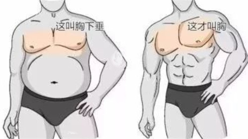 男性胸部对比