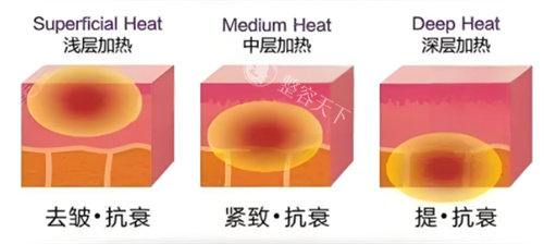 面部微调包括哪些项目?玻尿酸/光子嫩肤/水光/热玛吉/埋线...