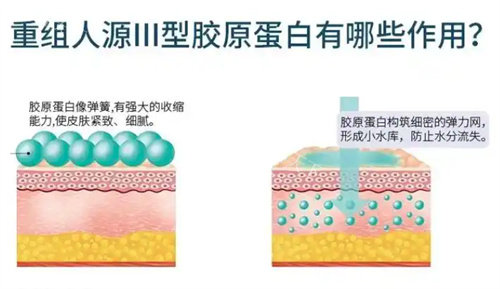 李钶7+1自体胶原蛋白填充做得怎么样?详细揭秘李钶胶原蛋白填充技术实力