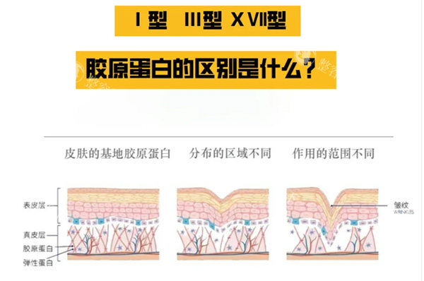 韩国胶原蛋白哪个牌子好？解析下Juvelook、TheraFill、双美等