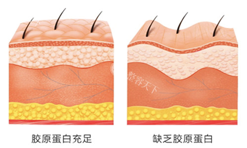 韩国 Juvelook 胶原蛋白有哪些型号？分为蓝瓶（水光再生型号）和黑瓶（填充型号）两种