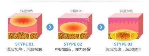 热拉提成效到底能撑多久？真实实例+3大影响因素，看完不踩坑！