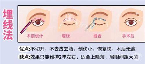 广州慕新医疗美容做双眼皮实力如何？技术成果与优势口碑双解析