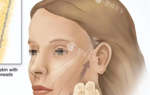 微拉美提升方向动画展示 微拉美提升方向动画展示