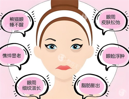 眼部年轻化整形大概多少钱？解析眼袋去除|提眉|眼部激光治疗等不同术式的费用