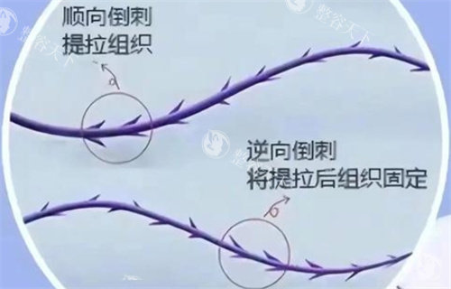 恒生PPDO线与鱼骨线哪个好? 恒生PPDO线与鱼骨线哪个好?