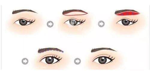 提眉术的价格一般是多少钱? 提眉术的价格一般是多少钱?
