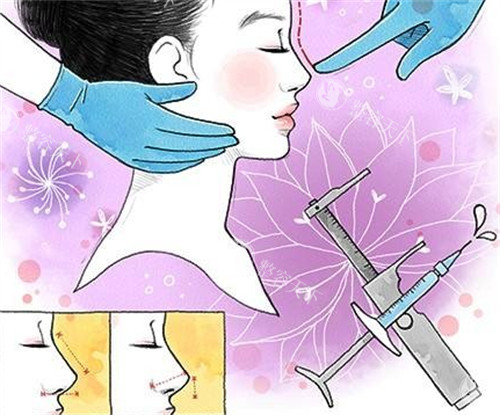 杭州虎山林畔医美中心怎么样?拱墅区正规整形机构|整形项目全技术好|口碑评价高